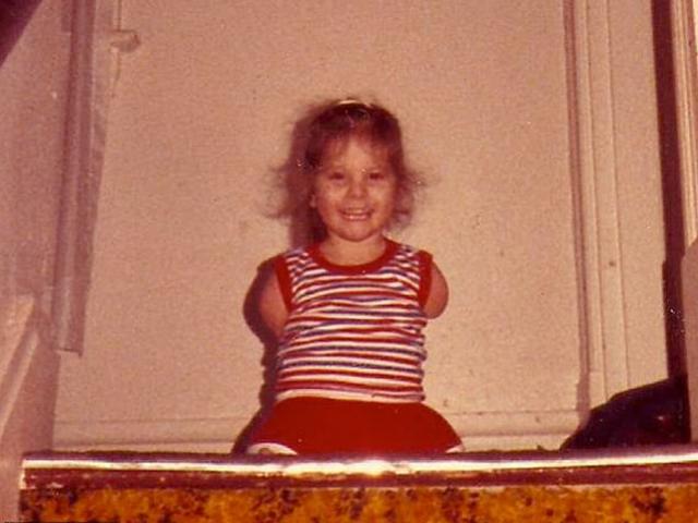 Hình ảnh bất ngờ của bé gái bị bố mẹ ruột ruồng bỏ 37 năm trước vì không tay chân