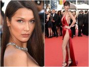 Sức khỏe - "Nữ hoàng" hở bạo đình đám MXH cùng gia đình từng nguy kịch vì căn bệnh lạ