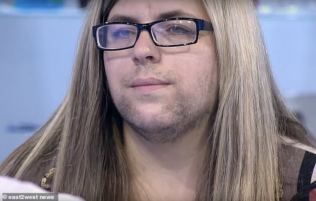 Sau khi sinh, người phụ nữ đột nhiên biến thành đàn ông khiến chồng không dám hôn - 1