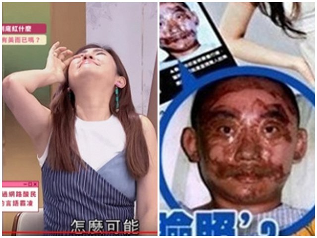 Selina S.H.E bật khóc kể lại chuyện 9 năm trước: Từng bị gọi là lợn quay sau tai nạn bỏng