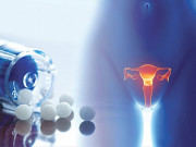 Sức khỏe - 6 việc gây suy buồng trứng chuyên gia khuyên đừng làm, chỉ 1 việc thôi cũng rất tai hại