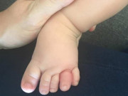 Làm mẹ - Sợi tóc mỏng cứa đứt da chân bé sơ sinh, mẹ nhìn kĩ phát hiện điểm đáng sợ