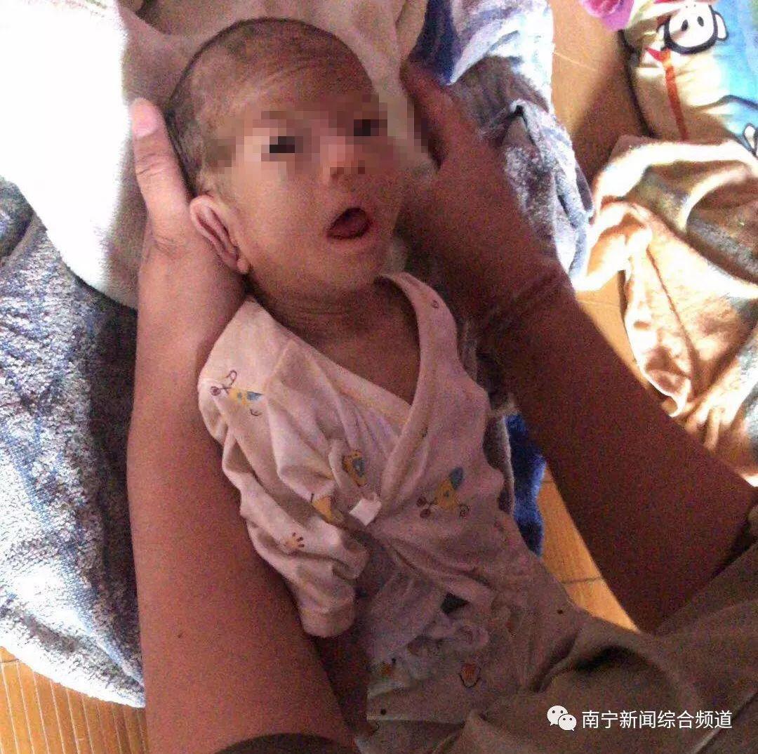 be so sinh suy dinh duong nghiem trong vi bo pha sua trong bat bang nuoc lanh cho an - 1