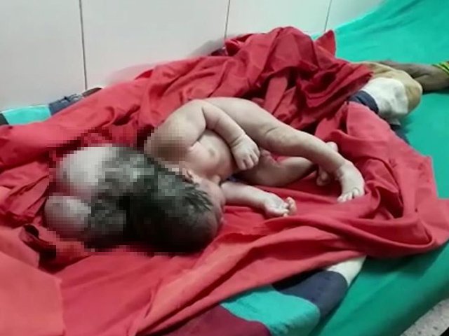 Mẹ sinh thường đau như chết đi sống lại, nhìn đứa trẻ chào đời bác sĩ câm nín