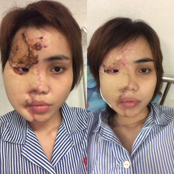 Thiếu úy công an tạt axit vợ sắp cưới: Nạn nhân lần đầu nói về tin đồn cặp đại gia - 2