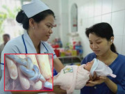 Bà bầu - Mổ cấp cứu cho mẹ Cần Thơ, bác sĩ choáng khi dây rốn bé thắt nút như tóc tết