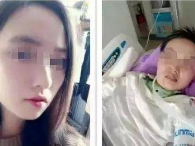 Cô gái 20 tuổi bị viêm não, nằm viện suốt 1 năm vì loại côn trùng nhiều nhà cũng gặp