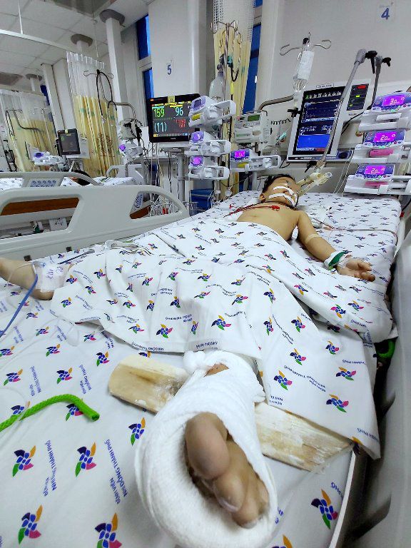 tp.hcm: be trai 5 tuoi treo qua may giat ngoai ban cong, roi tu tang 12 chung cu xuong dat - 1