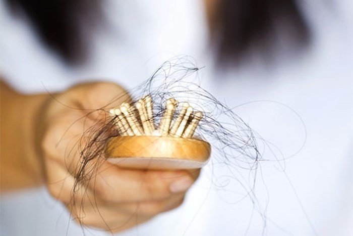 Tóc rụng nhiều phải làm sao để chấm dứt? - 1