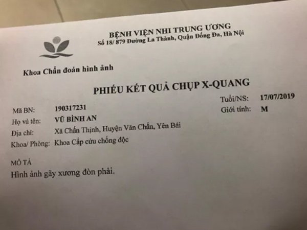 chua kip vui mung vi con chao doi, san phu choang vang nhan tin con bi gay xuong don - 2