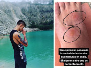 Xem ăn chơi - Đằm mình trong hồ nước màu ngọc bích, nam thanh niên phải nhập viện vì thiếu hiểu biết