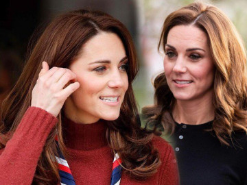 Công nương Kate bị đồn tiêm botox trẻ hóa làn da và đây là phản ứng của Hoàng gia Anh