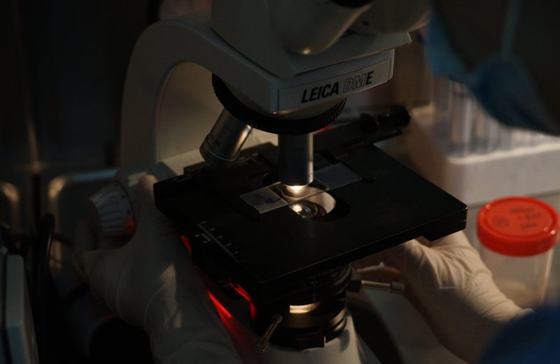 Kỹ thuật viên đặt lam kính lên kính hiển vi để soi hình dạng tinh trùng.
