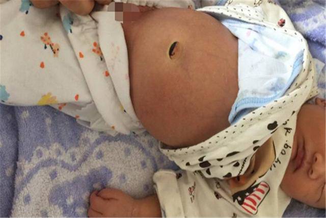 Bé 12 tháng ngã từ trên giường xuống đất, bà bảo ổn nhưng con qua đời 4 ngày sau - 1