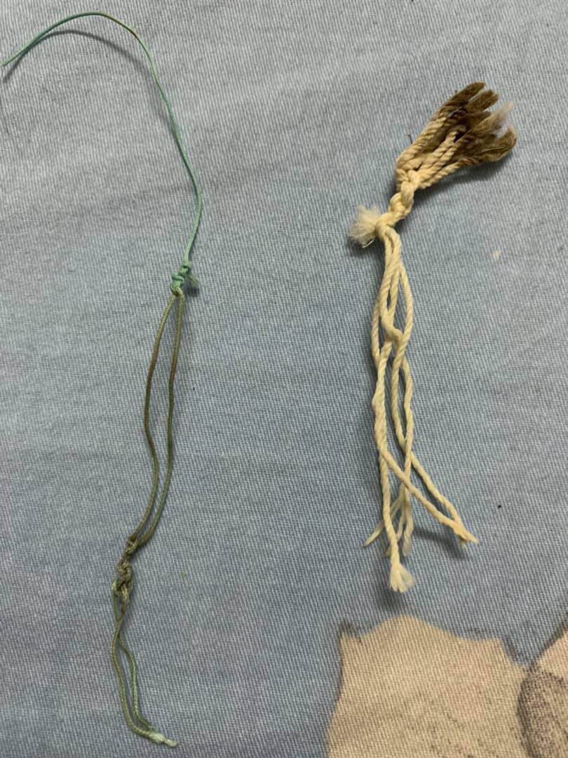 Ngạc nhiên vì dễ dính bầu, 9X mang thai nằm “treo chân” giữ con, cả ngày chỉ ăn với nằm - 2