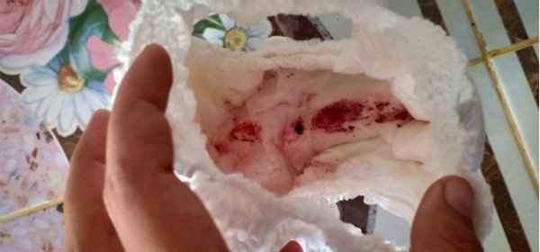 Vùng kín của con gái 4 tuổi chảy nhiều máu, mẹ khiếp vía khi phát hiện thủ phạm bất ngờ - 1