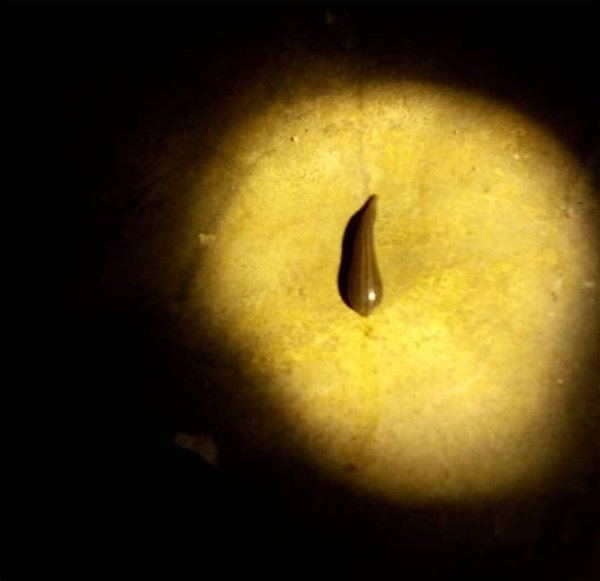 Vùng kín của con gái 4 tuổi chảy nhiều máu, mẹ khiếp vía khi phát hiện thủ phạm bất ngờ - 2