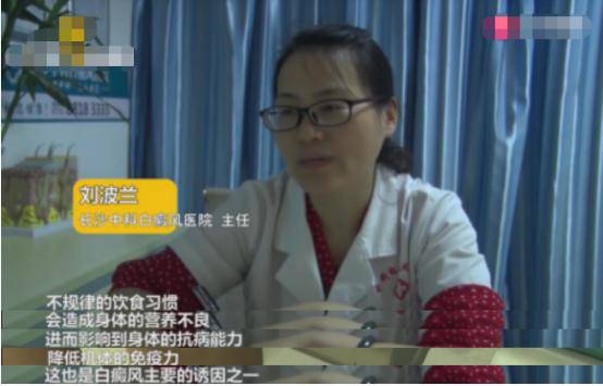 Cậu bé 8 tuổi mắc bệnh bạch biến vì thường quên làm điều này mỗi buổi sáng - 2