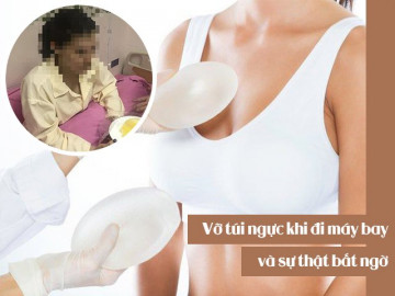 Sự cố vỡ túi ngực khi đi máy bay và sự thật bất ngờ không phải ai cũng biết