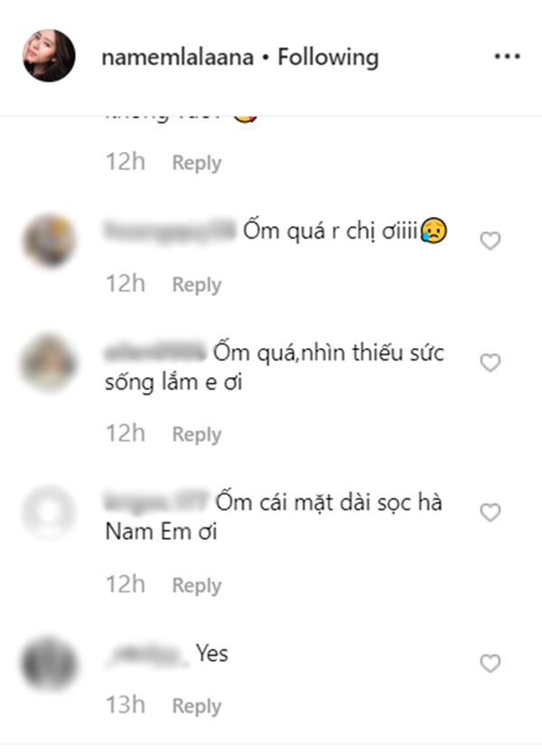 Hết hồn với gương mặt Nam Em, giảm cân thế này thì giảm làm gì? - 3