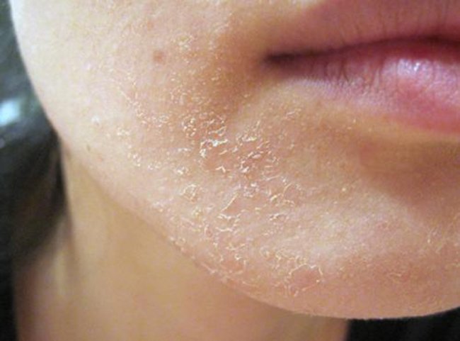 Nếu da mặt có những dấu hiệu dưới đây, bạn cần thay đổi quy trình skincare ngay lập tức - 1