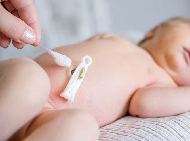 Cách chăm sóc trẻ sơ sinh đúng cách ( cách chăm sóc rốn)