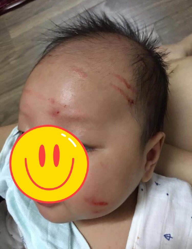 Ganh tị vì mẹ chăm em hơn, bé 2 tuổi lẻn vào phòng em làm điều khiến mẹ xót xa - 3