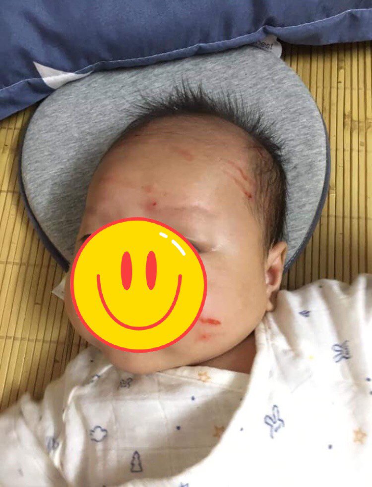 Ganh tị vì mẹ chăm em hơn, bé 2 tuổi lẻn vào phòng em làm điều khiến mẹ xót xa - 1