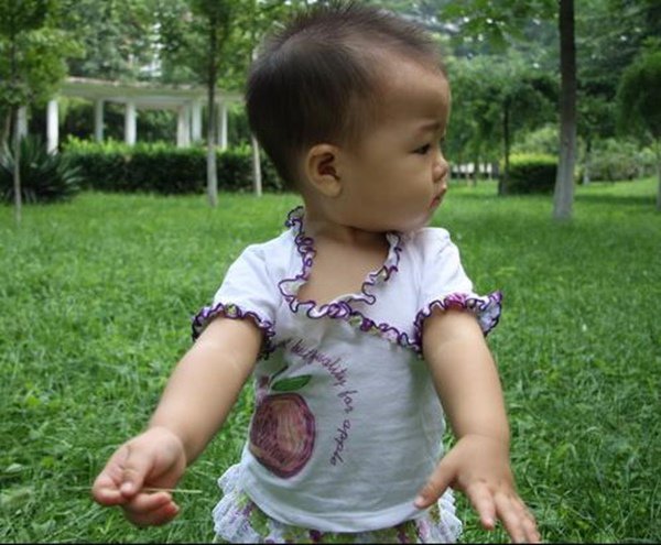 Con gái xương ngực như amp;#34;ức gàamp;#34;, mẹ trẻ hối hận vì nghe mẹ chồng nuôi con sai cách - 1