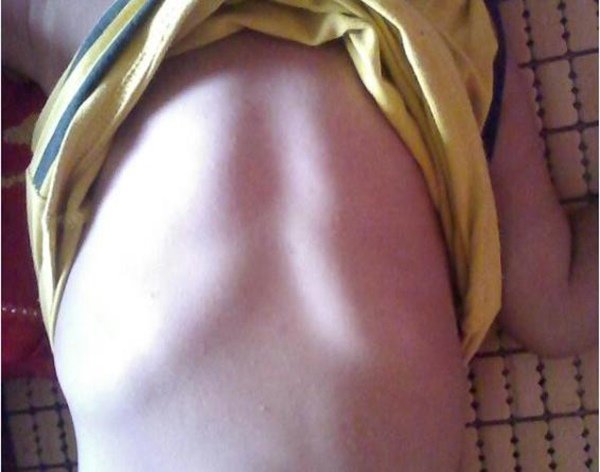 Con gái xương ngực như amp;#34;ức gàamp;#34;, mẹ trẻ hối hận vì nghe mẹ chồng nuôi con sai cách - 3