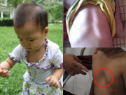 Làm mẹ - Con gái xương ngực như "ức gà", mẹ trẻ hối hận vì nghe mẹ chồng nuôi con sai cách
