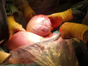 Tin tức - Bé trai nặng gần 5kg còn nguyên trong bọc ối, mẹ hoảng hốt tưởng "người ngoài hành tinh"