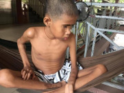 Tin tức - "Có bé ra đi ngay lúc tay vẫn còn cắm kim, nhìn cảnh đó, vợ tôi cứ khóc nấc lên”