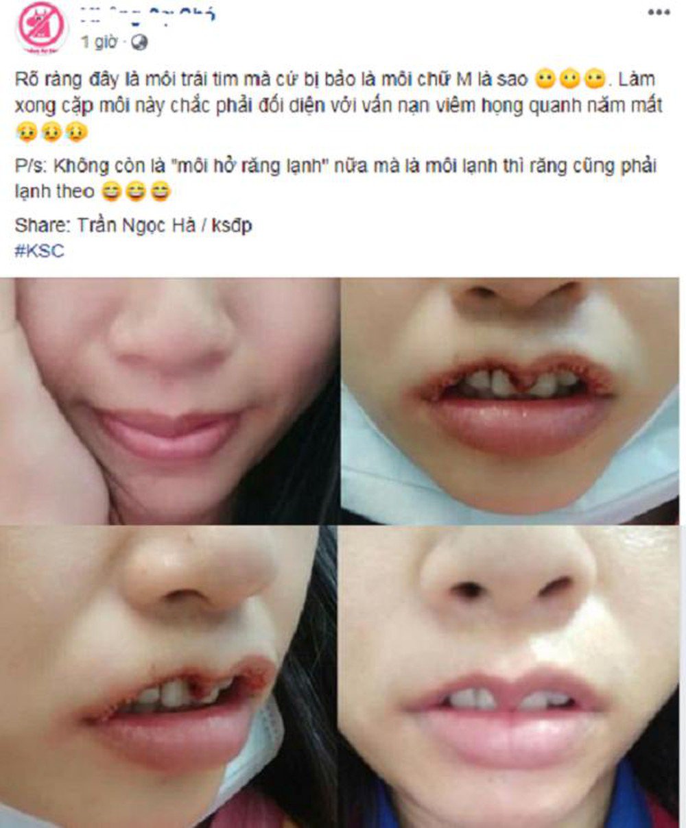 Môi trái tim xưa rồi, đôi môi cánh én uốn lượn mới là xu hướng chị em đang theo đuổi? - 11