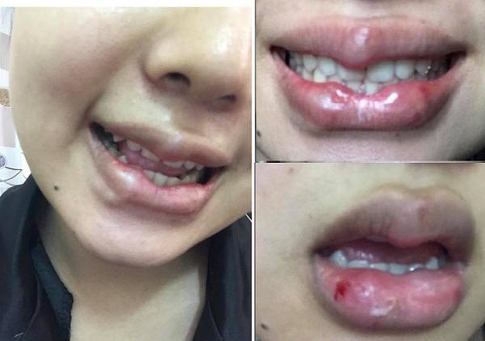 Môi trái tim xưa rồi, đôi môi cánh én uốn lượn mới là xu hướng chị em đang theo đuổi? - 13