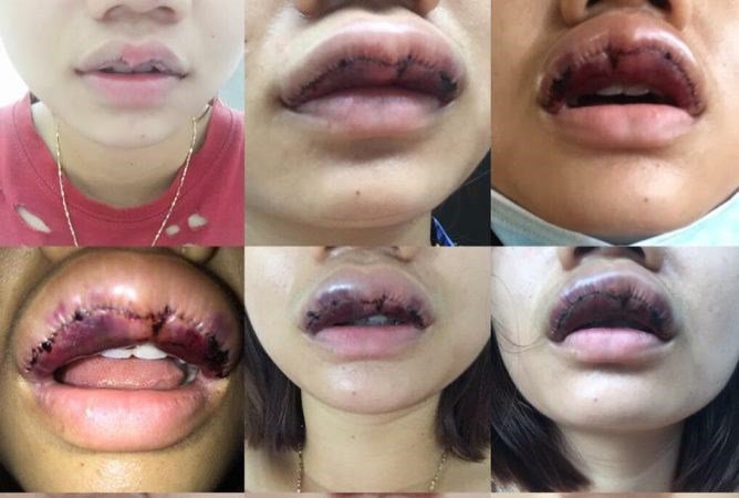 Môi trái tim xưa rồi, đôi môi cánh én uốn lượn mới là xu hướng chị em đang theo đuổi? - 12