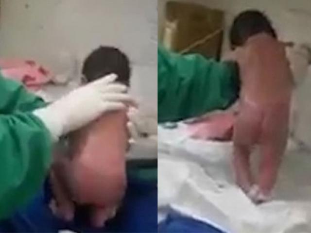 Những bé sơ sinh vừa chào đời đã gây bão mạng: Đứng dậy bước đi sau vài phút lọt lòng