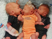 Bà bầu - Không thể tin nổi mẹ mang 3 thai trong bụng đến tuần 34  vẫn không hề biết