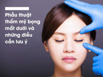 Bỏ túi ngay những kiến thức này nếu không muốn trở thành thảm họa sau cắt bọng mỡ mắt