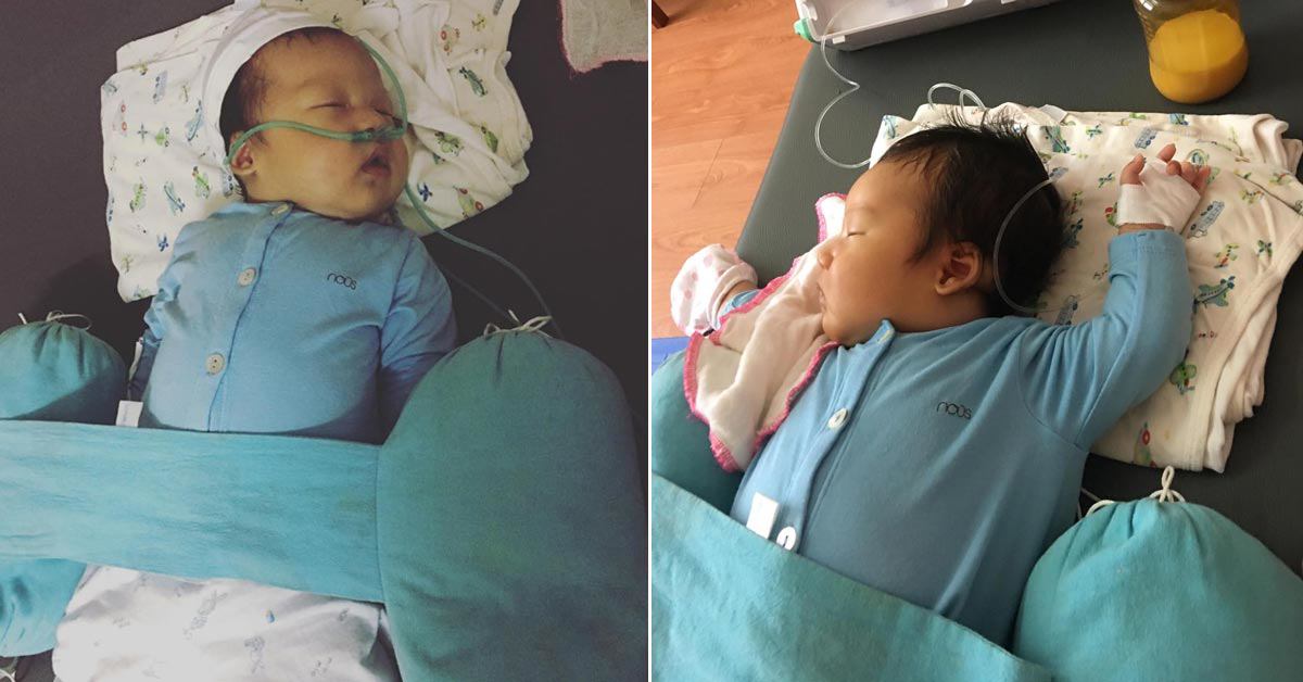 Con 20 ngày tuổi khó thở, mẹ giật mình khi biết bé nhiễm virus từ nụ hôn của chị bé - 3