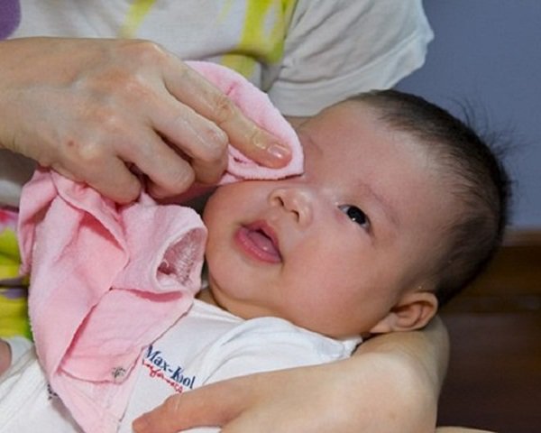 Trẻ sơ sinh bị đau mắt phải chữa trị tại nhà như thế nào? - 2