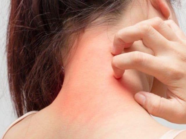 13 nguyên nhân gây ngứa khắp người càng gãi càng ngứa