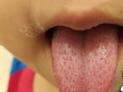 Sức khỏe - Trẻ 5 tuổi bị sốt và có "lưỡi dâu tây", bác sĩ khuyên tới viện gấp kẻo nguy tính mạng