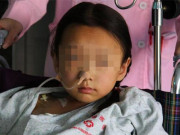 Sức khỏe - Bé gái cổ to bất thường, đi khám mẹ ngỡ ngàng vì con bị bệnh tưởng chỉ người lớn mắc