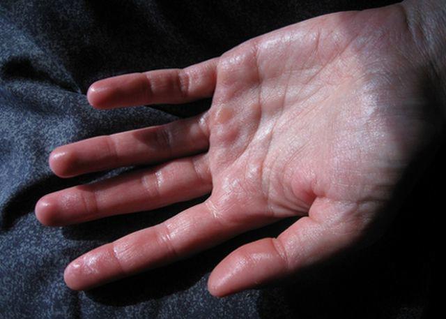 4 biểu hiện xuất hiện vào giữa đêm khi ngủ, đi khám gan ngay trước khi quá muộn - 2