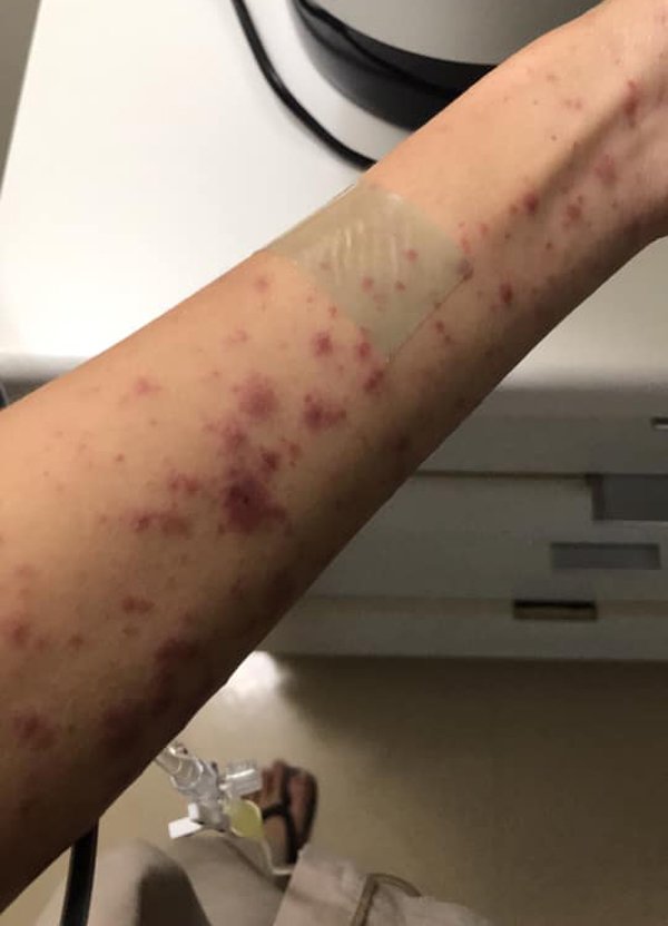 nguoi phu nu noi phat ban kin khap nguoi vi thoi quen suot 3 thang ai cung can phai tranh - 4