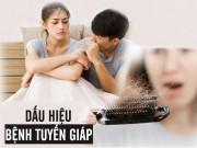 Sức khỏe - Căn bệnh ở cổ, chị em mắc nhiều hơn nam giới: Rụng tóc, giảm ham muốn hãy coi chừng