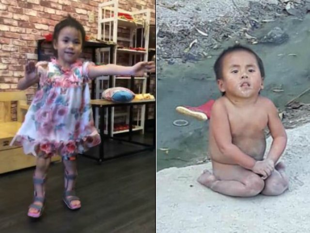 Sau tất cả, bé Pàng liệt 2 chân không manh áo giữa trời đông đã có thể tự đứng lên