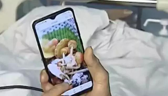 Hai mẹ con bị suy gan chỉ vì loại thực phẩm tưởng lành nhưng hóa ra rất độc - 2