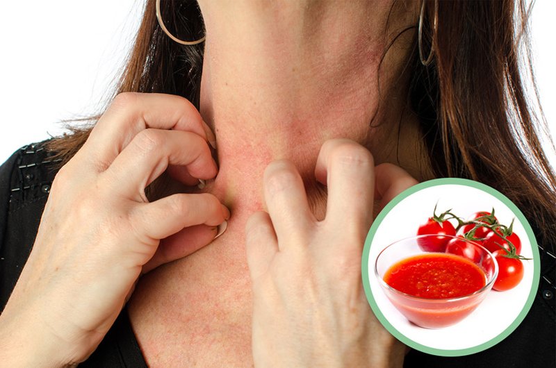 Cà chua chứa một hợp chất gọi là histamine, giúp tăng cường hệ thống miễn dịch. Điều đó thường xuất hiện dưới dạng các phản ứng dị ứng như phát ban, sưng lưỡi,... Với người dị ứng với cà chua, triệu chứng đó có thể nghiêm trọng hơn.
